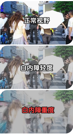 白内障别等“熟透”才做！ 早选飞秒，少遭罪、